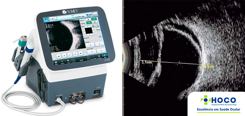 Ecografia Ocular