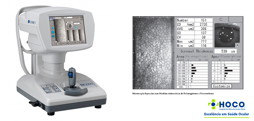 Microscopia Especular